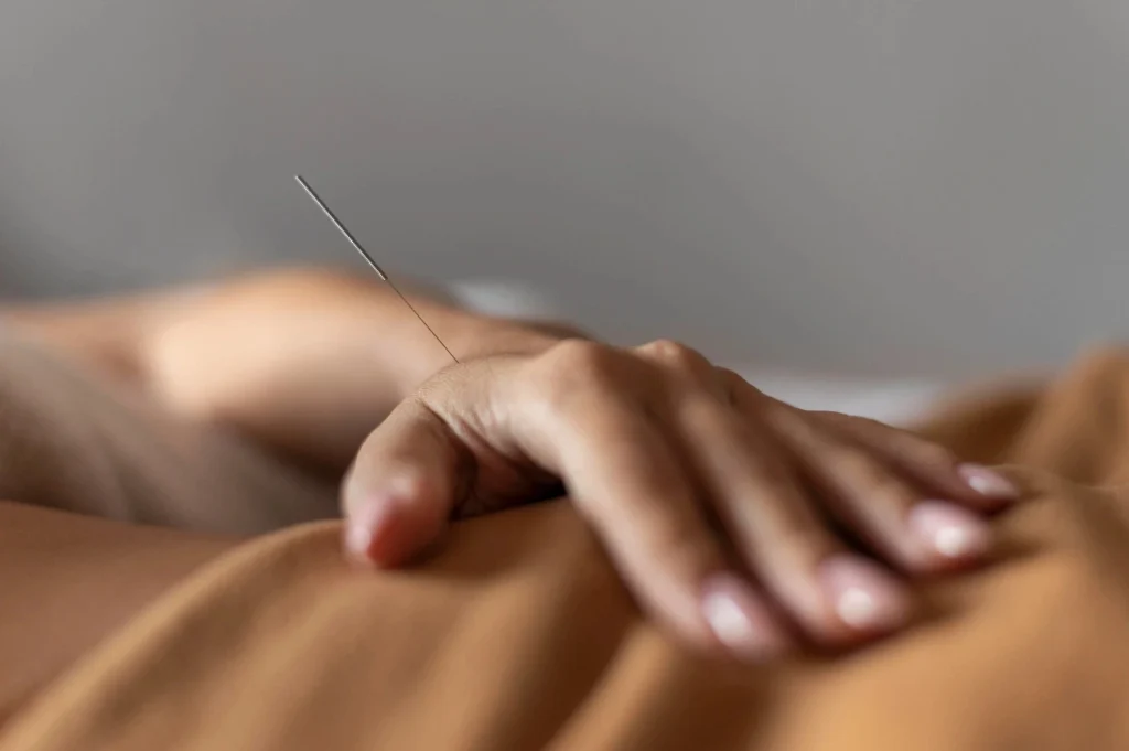 is acupuncture good for anxiety