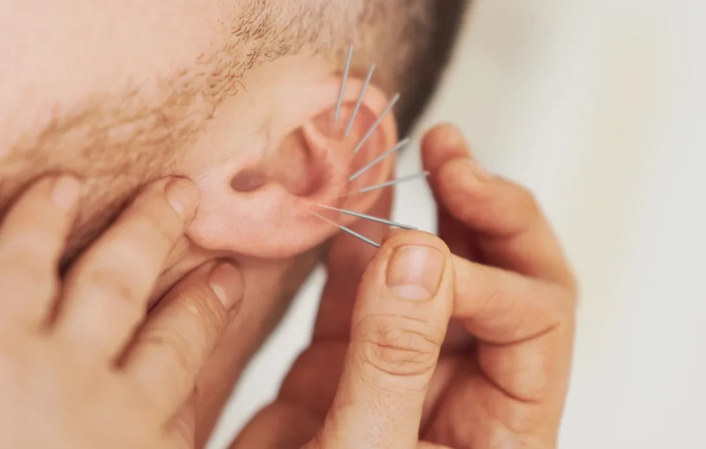 auriculotherapy near me