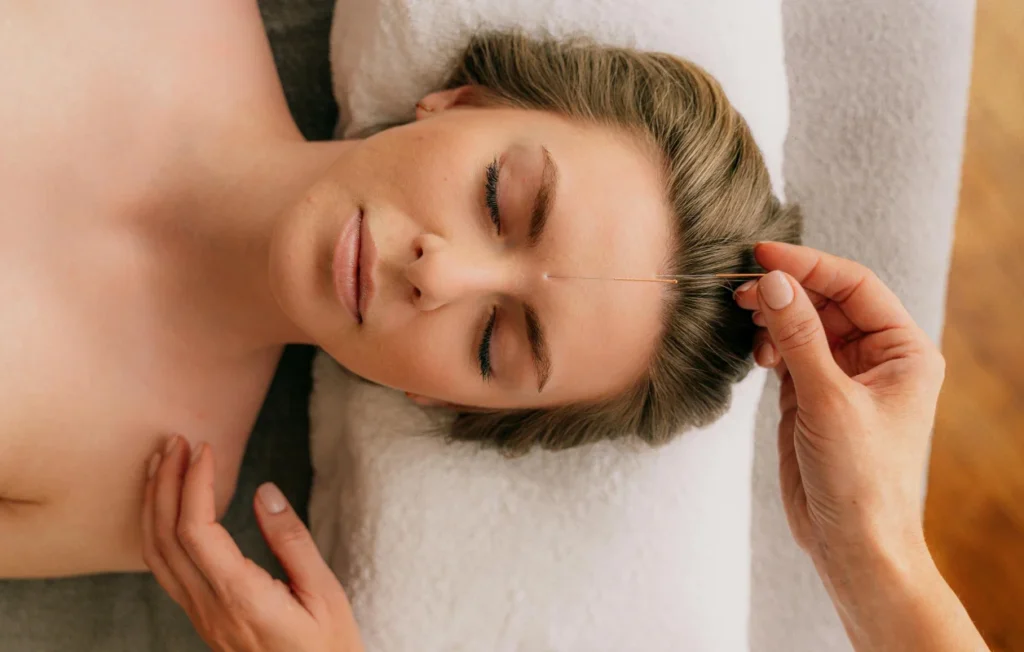 facial acupuncture near me