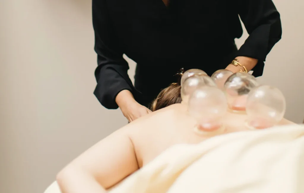 cupping near me