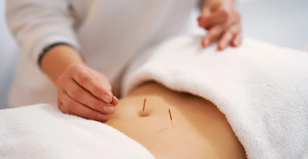 fertility acupuncture near me