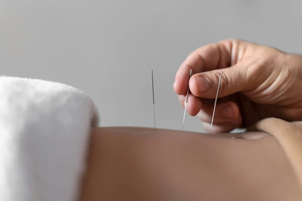 acupuncture lincoln park
