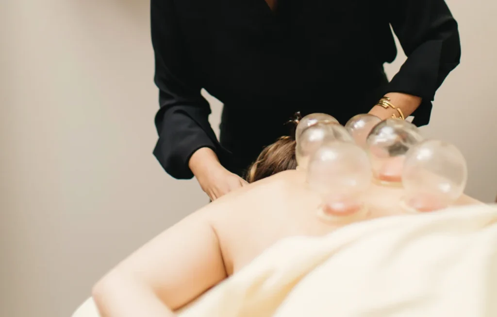 cupping therapy near me
