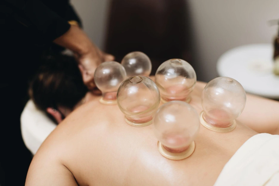 cupping therapy in bucktown