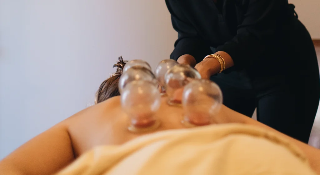 cupping near me