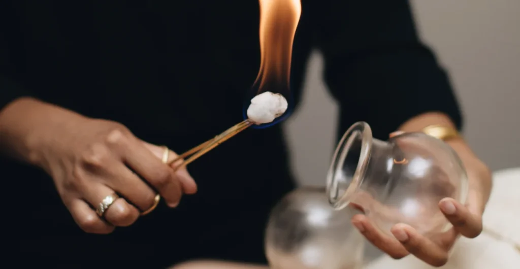 cupping therapy in logan square