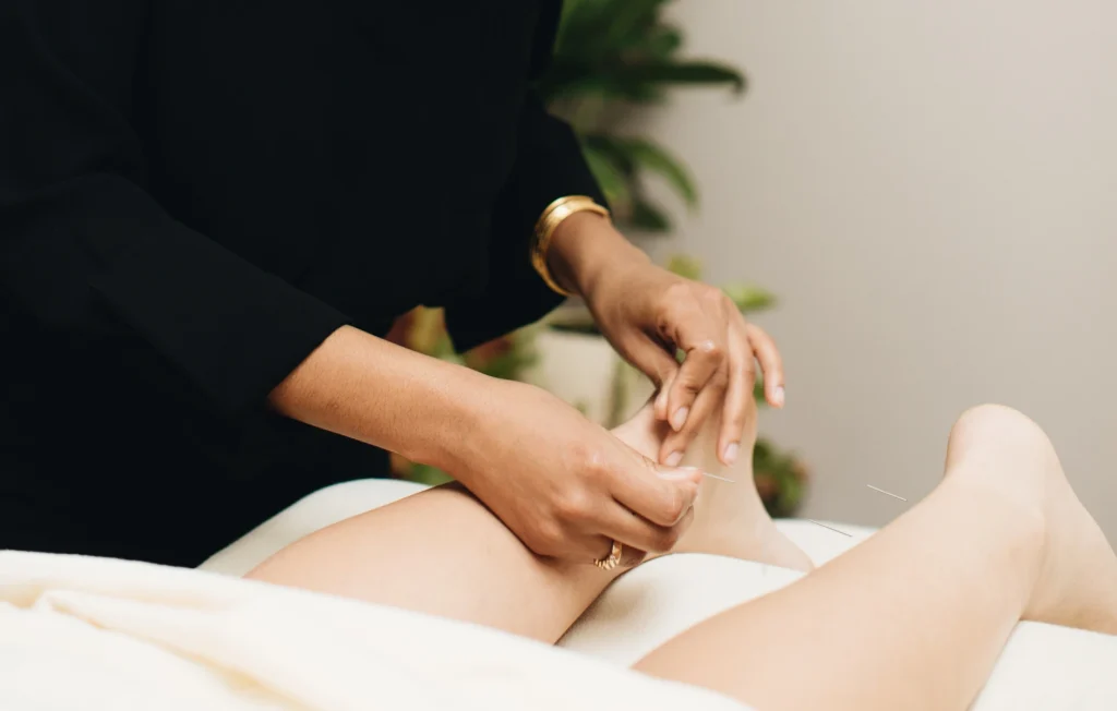 acupuncture for headaches near me