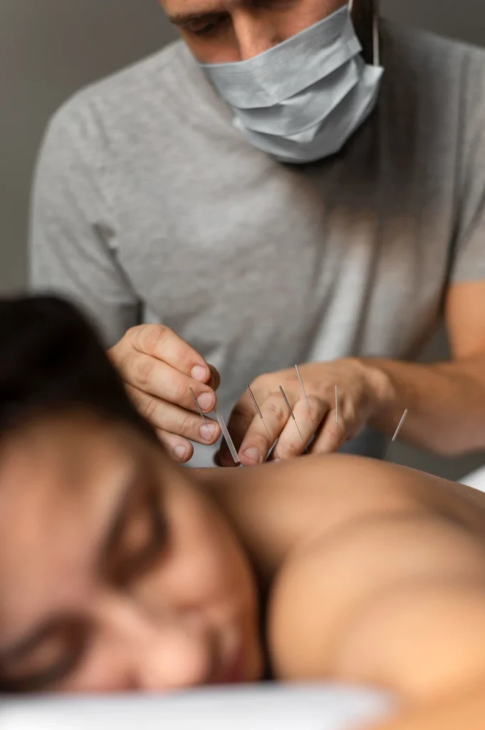 acupuncture points for weight loss