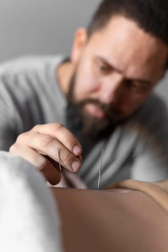 insomnia acupuncture for sleep