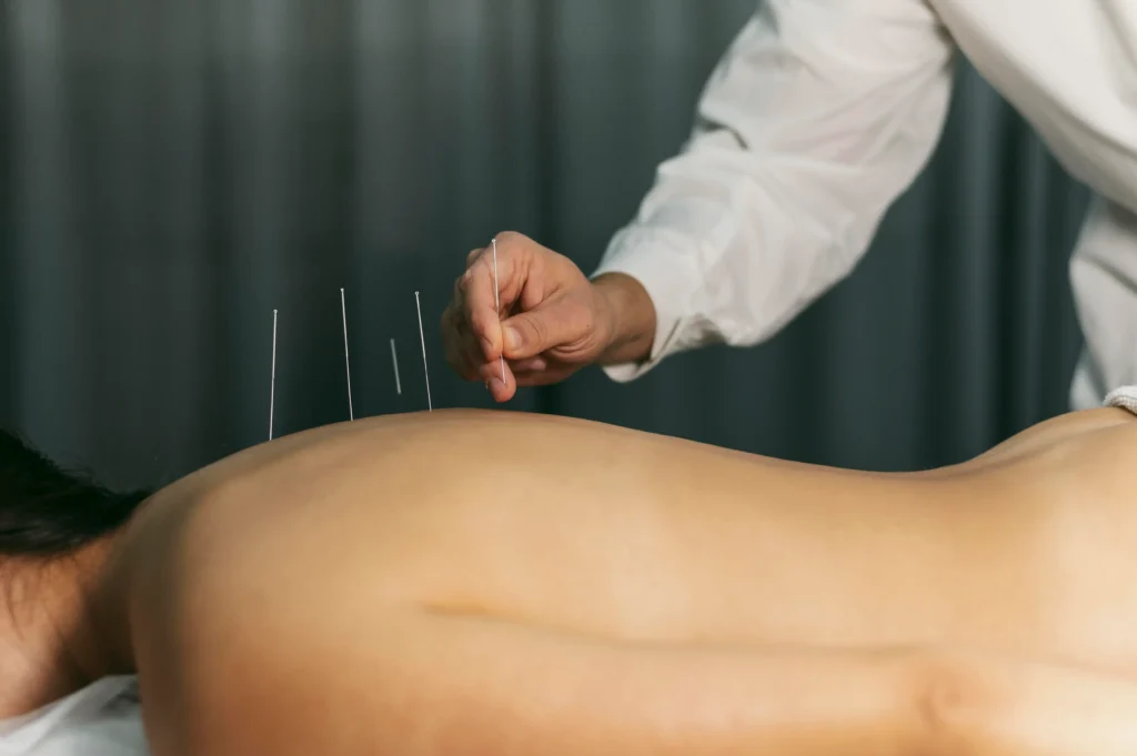 acupuncture for hormonal imbalance