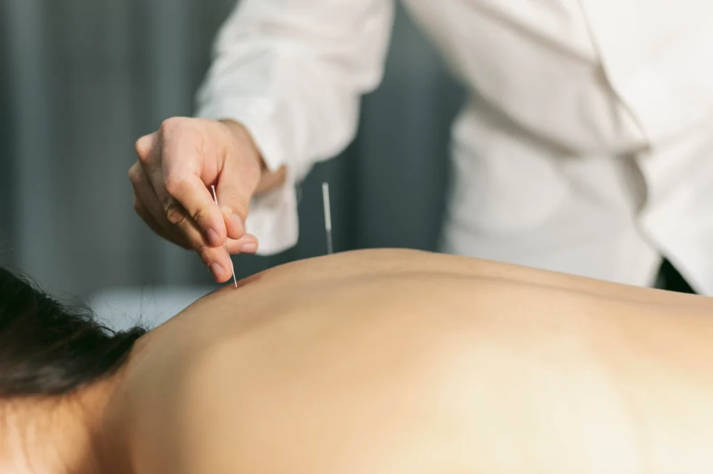 acupuncture for hormone balance