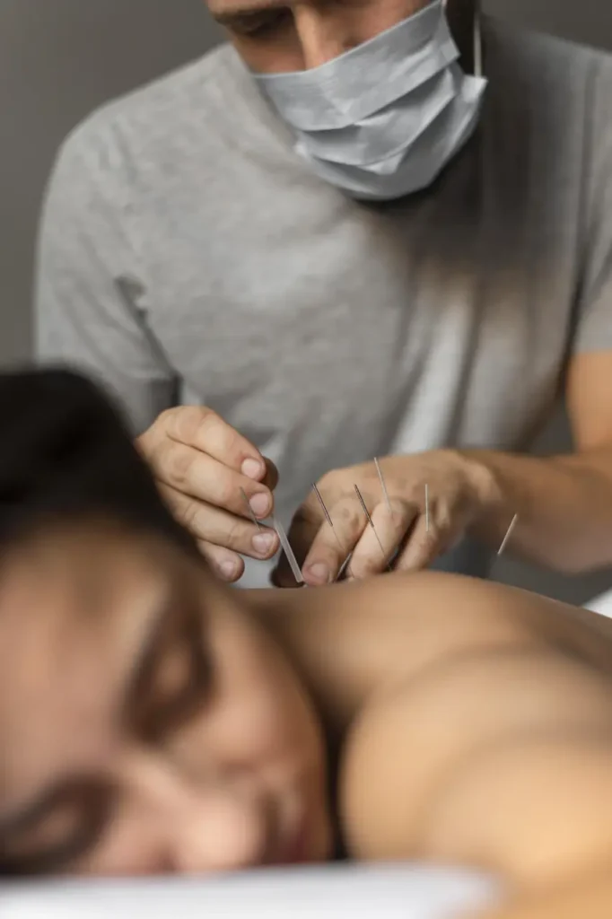 benefits of acupuncture